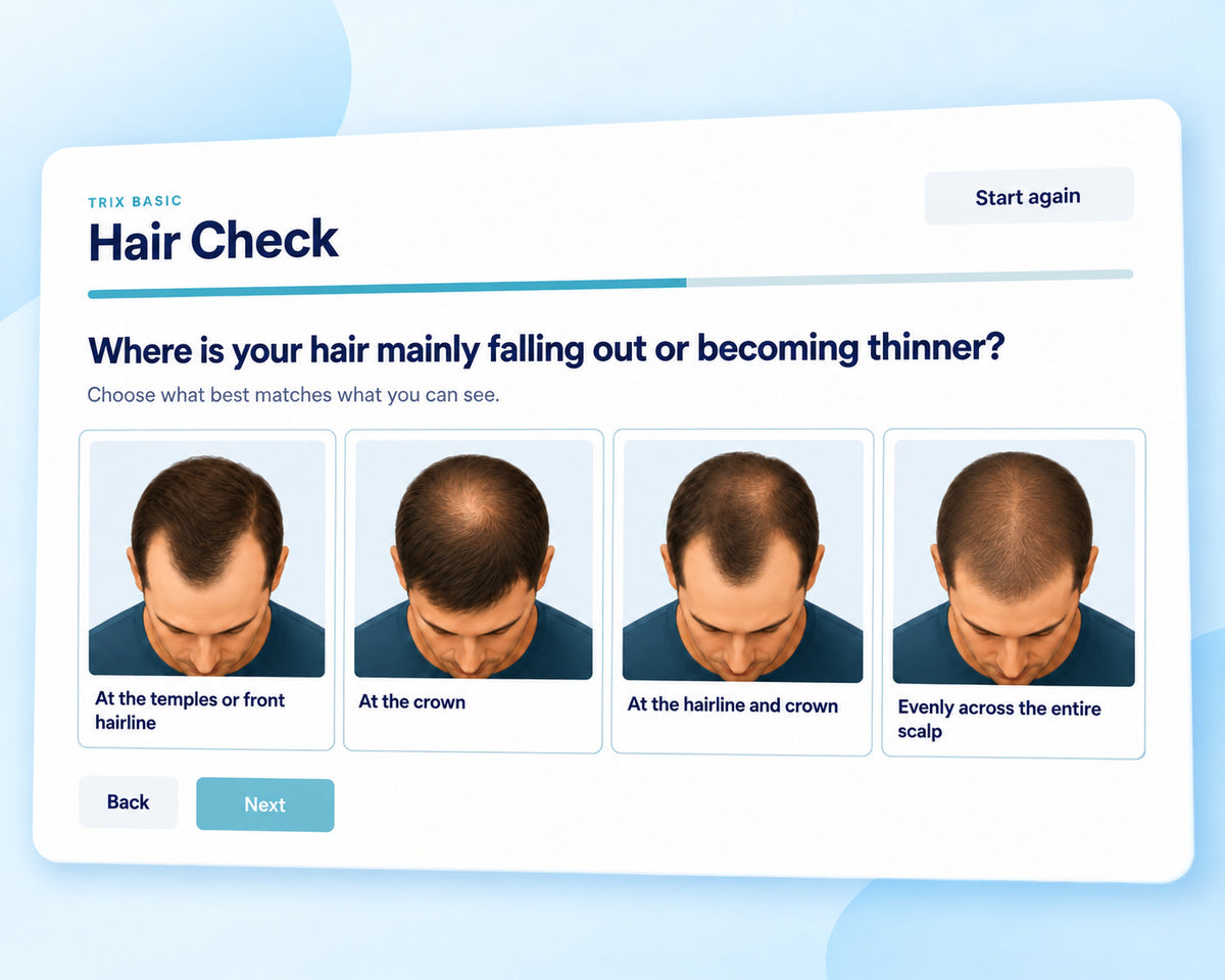 TRIX Basic Hair Check with visual options for male hair loss patterns.
