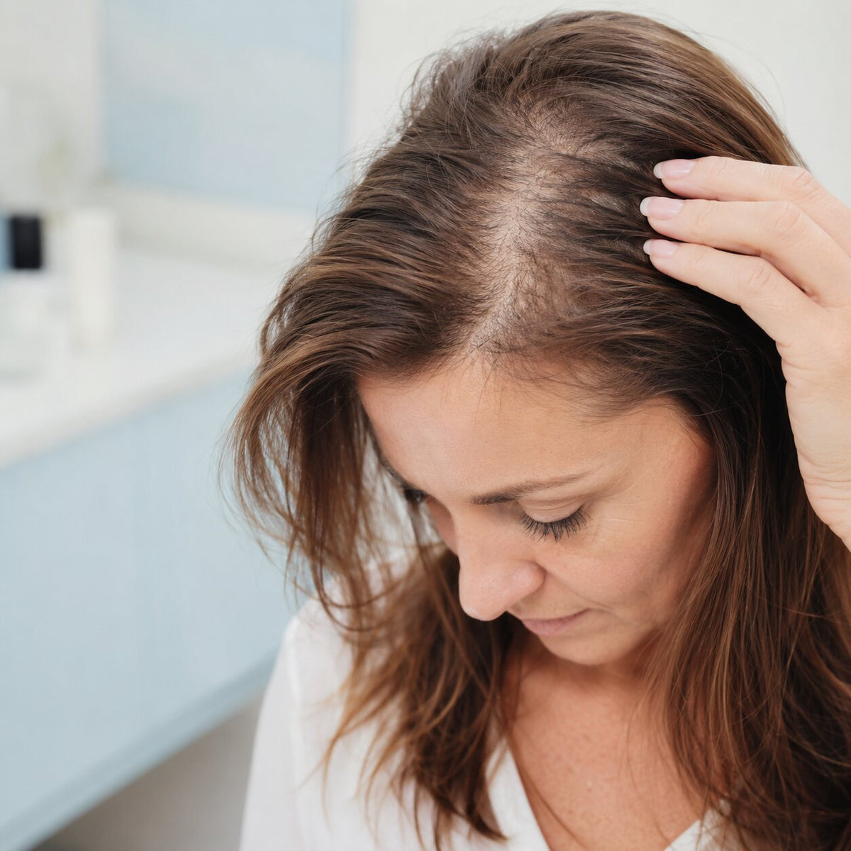 Illustration: 5-alpha-reductase and hair loss