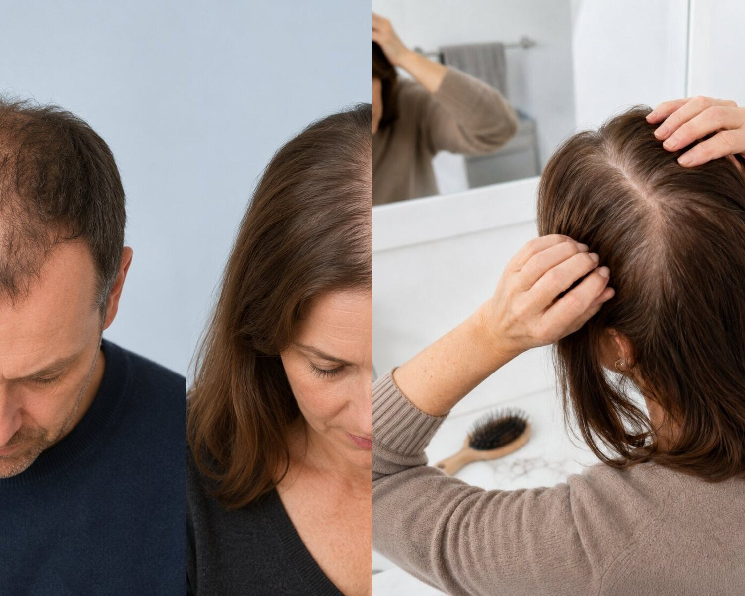 Comparison between pattern hair thinning and diffuse hair loss